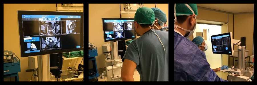 Prostat MR ve Prostat biyopsi